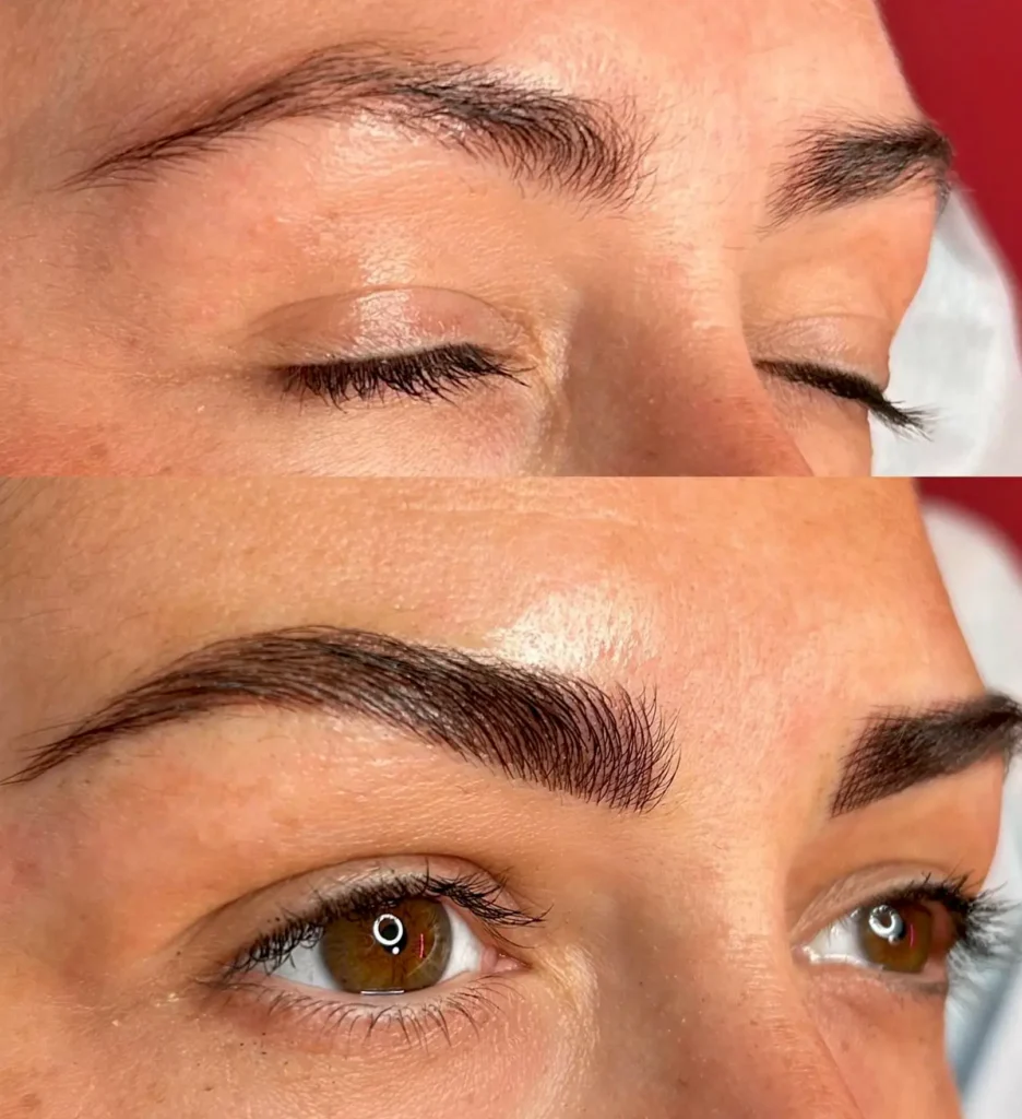 Swelling and Aftercare Missteps