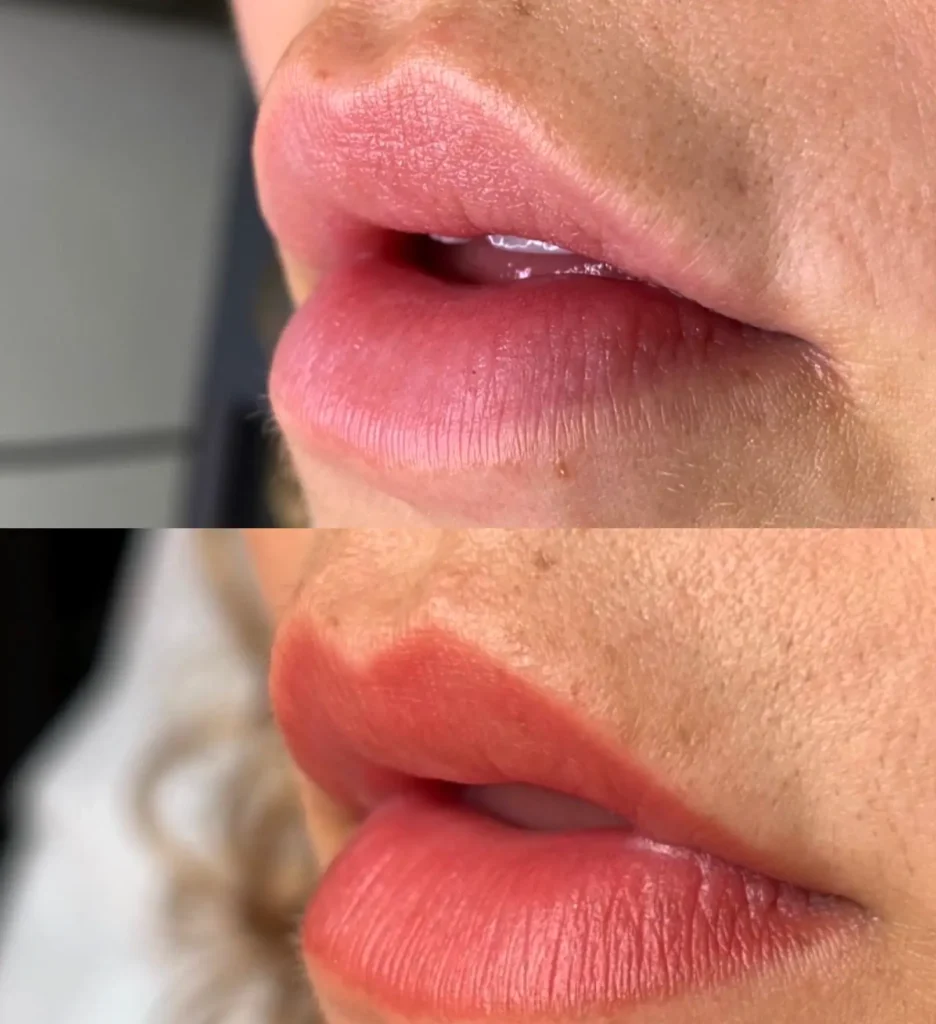 What Causes Cosmetic Tattoo Blowouts
