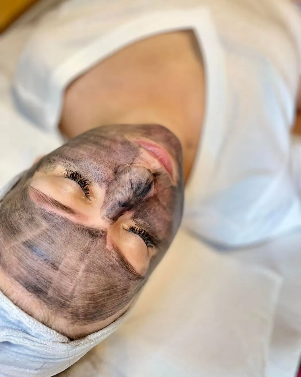 What Happens During the Treatment
